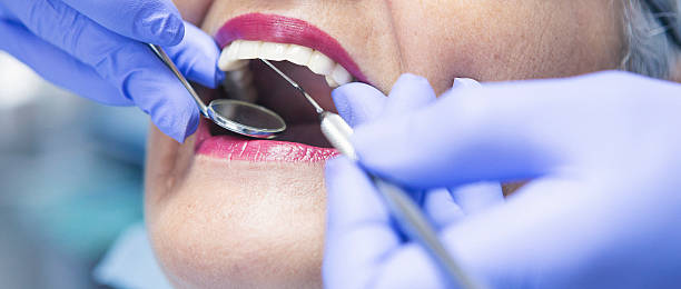 Best Emergency Tooth Extraction in Hickman, KY