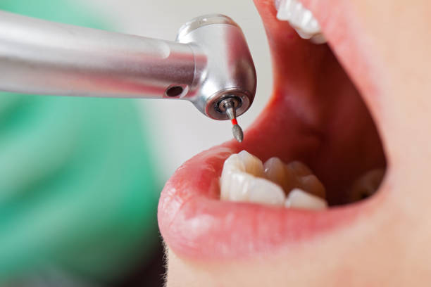 Best Emergency Broken Tooth Repair in Hickman, KY